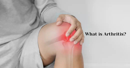 Understanding arthritis 