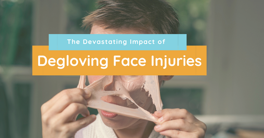 The Devastating Impact of Degloving Face Injuries